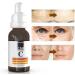ican london Vitamin C Serum for Face Anti Aging Serum with Hyaluronic Acid Anti-Aging & Brightening Serum for Dark Spots Wrinkles Glow & Radiance 30 ml - Buy Online on GoSupps.com