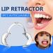 Buy Autoclavable Teeth Whitening Thermocouple - 3pcs Cheek Retractor Dentist Mouth Opener | Repeat Use International Shipping Available - Buy Online on GoSupps.com