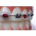 Snapcaps Paw Print 10 Ct: Bracket Cover Bumper for Braces - Orthodontic Accessories - Buy Online on GoSupps.com