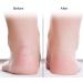 Silicone Gel Moisturizing Socks for Foot Care | Anti-Riss Protection for Plantar Fasciitis & Heel Spurs - Lindle M-Skin - Buy Online on GoSupps.com