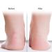 Silicone Moisturizing Gel Socks - Foot Care for Dry Feet & Cracked Heels - Anti-Riss Protection (Pink M) - Shop Internationally! - Buy Online on GoSupps.com