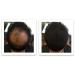FEBRON Spray Applicator Pump - Easy and Precise Hair Extension Application - Buy Online on GoSupps.com
