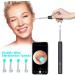 WiFi Ear Wax Remover Camera Wireless Ear Endoscope Ear Cleaner Spoon with Replacement Accessories Otoscope Ear Cleaner Ear Wax Remover WiFi Ear Wax Remover Camera Wireless New - Buy Online on GoSupps.com