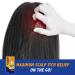 Scalpicin Max Strength Scalp Itch Treatment 1.5 oz - Pack of 3 - Buy Online on GoSupps.com