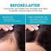 Biotin Shampoo for Hair Growth with DHT Blockers - Sulfate & Paraben-Free Thickening Shampoo for Hair Loss - Men and Women - 16oz - Buy Online on GoSupps.com