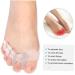 Khalery Bunion Corrector & Gel Toe Separator with Forefoot Pads - Hallux Valgus Relief for Foot Pain - Silicone Toe Spacer for Athletes, Dancers, Yoga - Buy Online on GoSupps.com