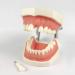 DYTAH Dental Teeth Model - Standard 28 Tooth Study Demo | Removable Adult Teeth Model for Dental Education - Buy Online on GoSupps.com