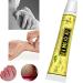 Navyue 5PCS Natural Chinese Herbal Cream for Eczema Psoriasis Dermatitis - Anti-Itch Relief for Inflammation and Rashes - Buy Online on GoSupps.com