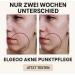  Generisch ELGEOO! Anti-acne treatment with 2% salicylic acid Anti-blemish cream for sensitive skin deep pore cleansing against pimples blackheads and impurities - Buy Online on GoSupps.com
