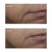 Perricone MD Vitamin C Ester Brightening Amine Face Lift 2 Fl Oz - Boost Radiance and Firmness - Buy Online on GoSupps.com