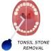 CTDWTNT Right-Angled Glass Cleaning Tool for Tonsil Stones - PVC Suction Ball Manual Cleaner | Teeth Dental Care - Yellow | International Shipping - Buy Online on GoSupps.com