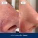 Hero Cosmetics Pore Release Blackhead Clearing Solution - Exfoliating Toner with BHA, PHA, AHA & 2% Salicylic Acid - 100ml - Buy Online on GoSupps.com
