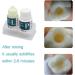 Tooth Repair Kit - Quick Fix for Damaged Teeth | Temporary Fillings & Bonding for Instant Dental Care - Buy Online on GoSupps.com
