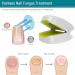 Lanlousy 905NM Nail Therapeutic Instrument Portable Painless Nail Therapy Device Anti- Silicone Easy to Use White - Buy Online on GoSupps.com