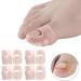 Ingrown Toenail Corrector Sleeves 4 Pairs Elastic Silicone Ingrown Toenail Correction Tool Thick Paronychia Treatment Corrector Big Toe Sleeves Toe Nail Healing Care Protector for Keep Nail Healthy - Buy Online on GoSupps.com