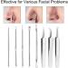 YIAGUN Acne Blemish Needles Tool Kit Nose Face Skincare 8-in-1 with Metal Case - Buy Online on GoSupps.com