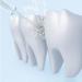 Buy KEDUODUO Portable Dental Cleaner - Effective Household Electric Floss for Tartar Removal | Fast International Shipping - Buy Online on GoSupps.com