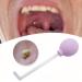 Tonsil Stone Remover Vacuum Tonsil Stone Removal Kit Tool Tonsil Stone Treatment Oral Suction Tool Dental Suction Mouth Cleaner Mouth Cleaning Oral Care Mouth Cleaner for Adults (Purple)