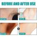 Skin Whitening Serum Skin Lightening Serum For Body Underarms Armpit Knees and Inner Thigh Dark Spot Remover Corrector Cream for Body Hyperpigmentation Treatment 1 - Buy Online on GoSupps.com