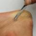 Foot Scraper Stainless Steel Foot Rasp Cutter Feet Dead Skin Callus Remover Pedicure Tool Pedicure Tool - Buy Online on GoSupps.com