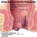 Dr. Cole's Organic Herbal Hemorrhoid Treatment Ointment - Natural Relief for Internal and External Hemorrhoids - Soothes Itching, Swelling, and Pain - All Ages - Buy Online on GoSupps.com