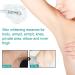 Skin Whitening Serum Skin Lightening Serum For Body Underarms Armpit Knees and Inner Thigh Dark Spot Remover Corrector Cream for Body Hyperpigmentation Treatment 1 - Buy Online on GoSupps.com