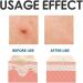 KYKHT Urticaria Antipruritic Ointment Urticaria Curing Plaster Ointment Balm Urticaria Ointment Urticaria Antipruritic Plaster Ointment Balm White Hives Ointment Cream Bottled (3PCS) - Buy Online on GoSupps.com