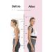 DFHBFG Posture Corrector Upper Back Brace - Adjustable Support & Neck Relief for Pain - International Shipping Available - Buy Online on GoSupps.com