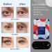 ONIYEA 15-Pack Unscented Steam Eye Masks for Dry Eyes Relief and Puffy Eyes - Disposable Moist Heating Compress Pads for Sleep - SPA Warm Eye Masks for Eye Fatigue - Buy Online on GoSupps.com