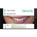 Instant Professional Teeth Whitening Kit - 10 Trays | Brighten Your Smile Fast - Buy Online on GoSupps.com