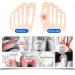 Carolhome Soft Gel Toe Protectors 14Pcs - Pain Relief for Ingrown Toenails, Calluses, Hammer Toes | Silicone Toe Covers for Foot Pain - Style 1 - Buy Online on GoSupps.com