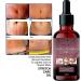 Stretch Mark Skin Oil - Reduce Scars Boost Elasticity | 40 ML - Best International Shipping - Buy Online on GoSupps.com