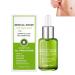 flysmus Advanced Scar Repair Serum Scar Removal Medical Grade Spray for All Types of Scars (1PCS)
