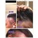 Organic Natural Hair Growth Oil Elixir - Handcrafted Scalp Treatment for Thinning Hair - Made in NYC USA - 2oz - Buy Online on GoSupps.com