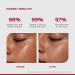 /PHD/ 10% Vitamin C Brightening Serum | For Glowing skin Oily skin Dry skin | Dark Spots & Uneven Tone Treatment | Face serum for Women & Men | Formulated with Global Dermatologists | 60ml - Buy Online on GoSupps.com