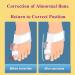 Big Toe Straightener & Bunion Corrector - Adjustable Hallux Valgus Protector for Men & Women - Effective Bunion Relief Splint - Buy Online on GoSupps.com