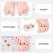 Gatuida Silicone Toe Separator + Bunion Corrector 2 Pairs - Thumb Splint Included | Overlapping Toe Relief | 3.6x3.5cm - Buy Online on GoSupps.com