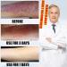Eczema Itching Skin Health Spray - Pi Fu Hu Li Bao Jian Ye | Eczema Relief Spray - Buy Online on GoSupps.com