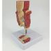 YOtat Human Pathological Hemorrhoids Model-Colorectal Hemorrhoid Lesion Model-Placed On The Base-is The Best Teaching Aid for Doctor-Patient Communication - Buy Online on GoSupps.com