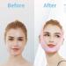 Face V Shaper Facial Slimming Bandage - Chin & Cheek Lift Strap | Anti-Wrinkle & Youthful Contour - Fast International Shipping - Buy Online on GoSupps.com