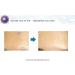 Buy Acne Seboderm Solution - Anti Sebum Treatment for Blemish-Prone Skin | Pore Shrinking Care Worldwide Shipping - Buy Online on GoSupps.com