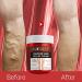 AUQUEST 80g Varicose Veins Treatment Cream - Relieve Dilated Capillaries & Phlebitis - Spider Leg Veins Removal - Buy Online on GoSupps.com