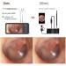 GIENEX Ear Wax Removal with Camera - Ear Cleaner Tool for Kids & Adults - Buy Online on GoSupps.com