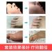 Ji yan Tie/Yat Tip Tor Corn & Callus Removing Plaster - 12 Plasters | Effective Corn & Callus Removal - Buy Online on GoSupps.com