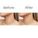Anti-Aging Silicone Neck & Chest Wrinkle Patches - Skin Firming & Moisturizing Treatment | Reusable Overnight Smoother for Decolletage - 1 Pack - Buy Online on GoSupps.com