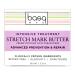 Intensive Treatment Stretch Mark Butter 5.5oz - Effective Solution for Stretch Marks - Buy Online on GoSupps.com