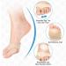 Anggrek Bale Cushion - Foot Protective Gel Pads for Metatarsal Support | 1 Pair Football Forefoot Cushions - Buy Online on GoSupps.com