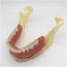 Zapion Dental Implant Model - Anatomical Lower Jaw Study Model for Overdentures & Teaching - Buy Online on GoSupps.com