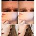 Beard Growth Roller for Men - 540 0.5MM Titanium Microneedle Roller - Buy Online on GoSupps.com
