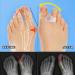 Gel Toe Separators 8 Pack - Toe Corrector & Spacer for Bunions, Hammer Toes, Overlapping Toes - Hallux Valgus Relief - Clear - Buy Online on GoSupps.com